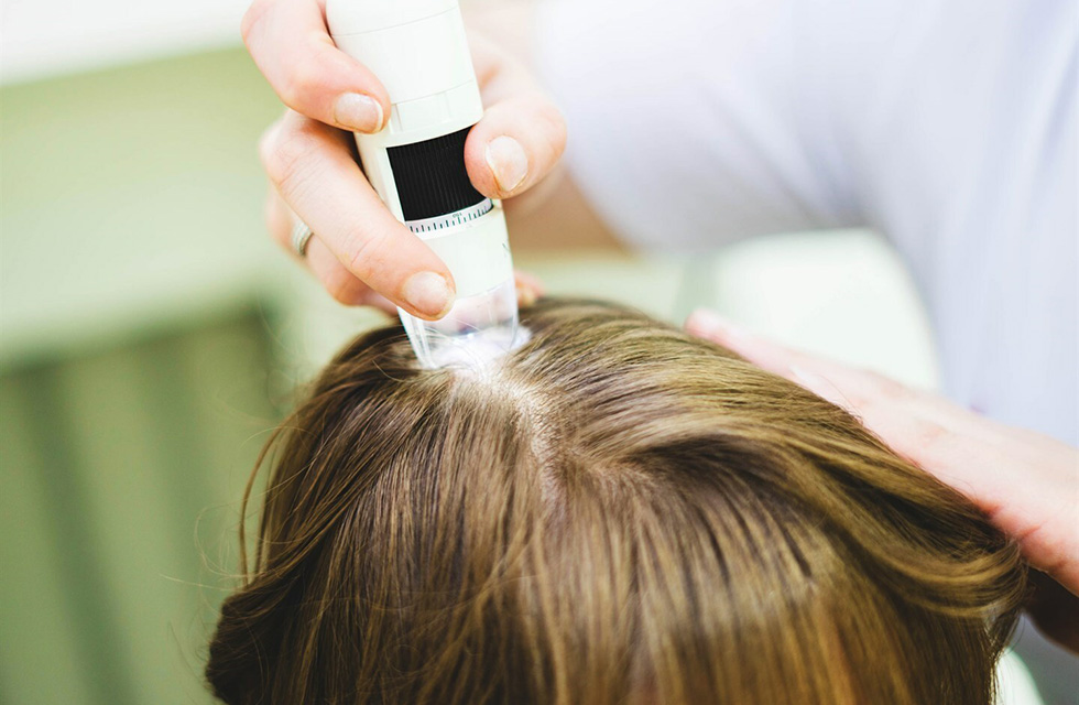 Hair loss treatment - Ästhetik Lab Procedure Gallery