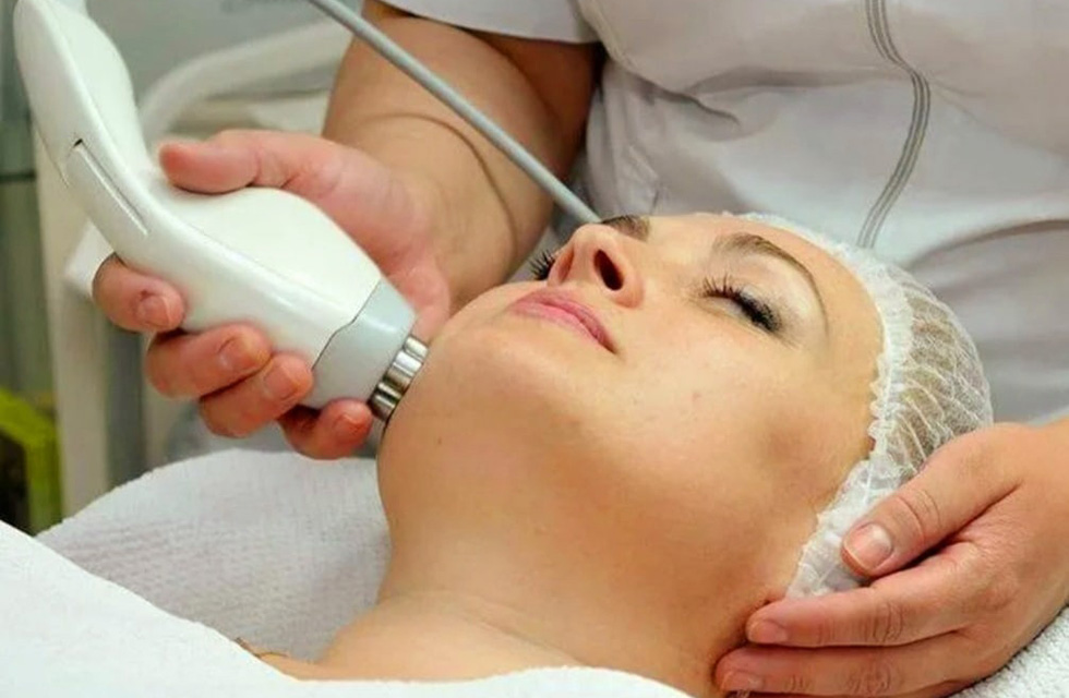 RF lifting - Ästhetik Lab Procedure Gallery