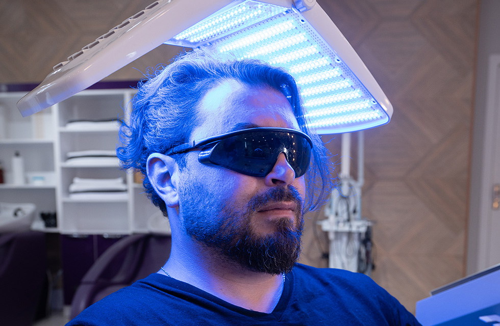 Dandruff treatment - Ästhetik Lab Procedure Gallery