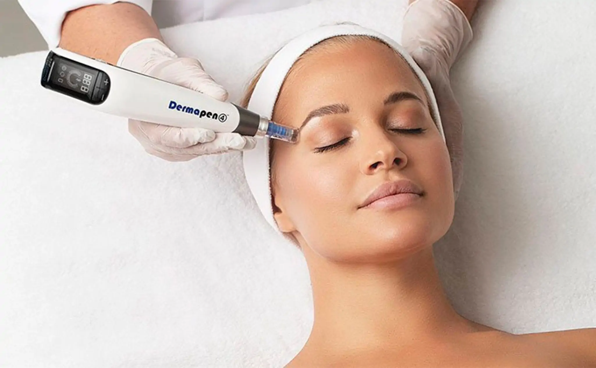 Dermapen - Ästhetik Lab Procedure Gallery