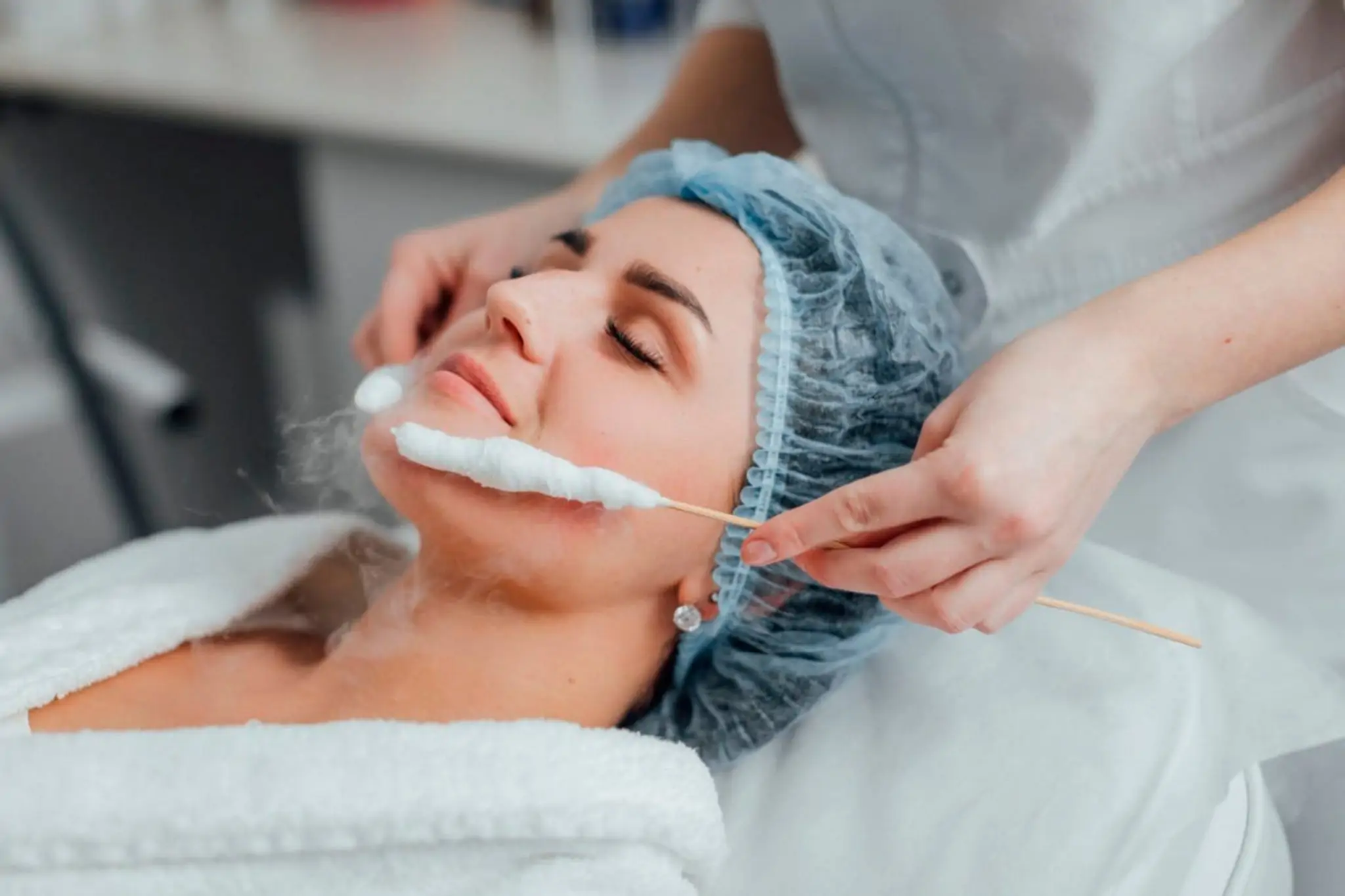 Cryotherapy - Ästhetik Lab Procedure Gallery