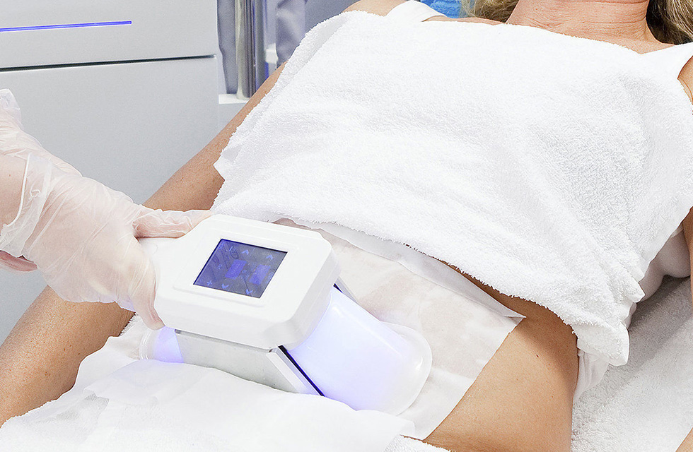 Cryolipolysis - Ästhetik Lab Procedure Gallery