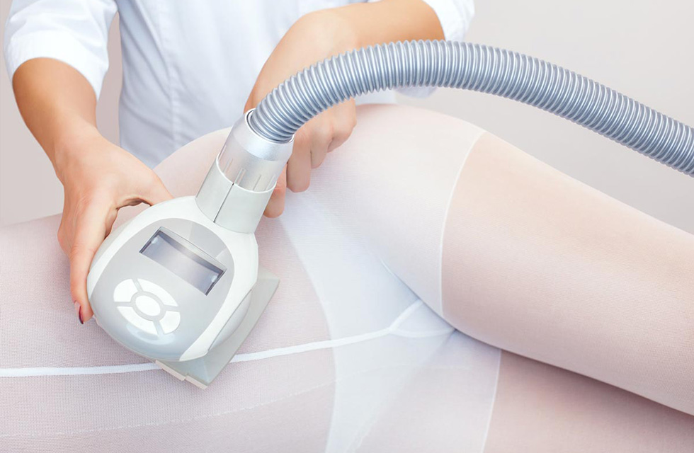 LPG massage - Ästhetik Lab Procedure Gallery